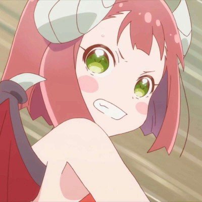 女子睡觉被15斤猫咪压致手腕骨折